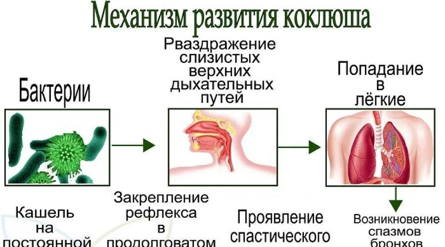 Механизм передачи возбудителя коклюша. Коклюш факторы передачи возбудителя инфекции. Коклюш способы заражения. Коклюш источник инфекции и пути передачи.