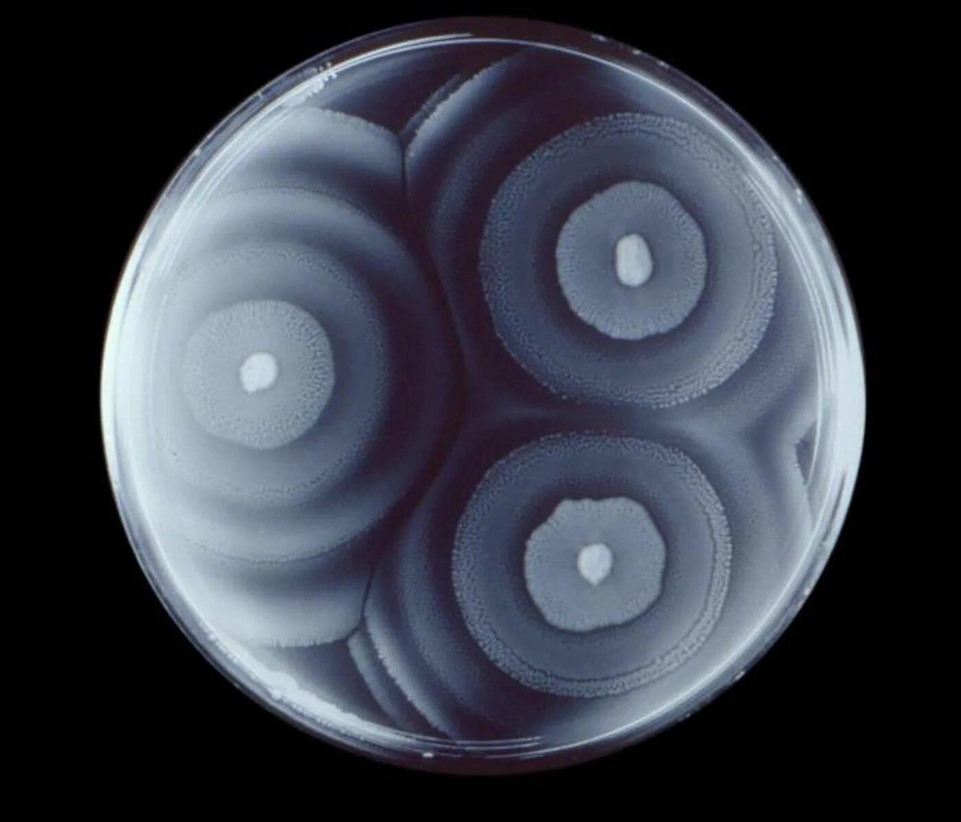 Proteus vulgaris (палочка протея). Протей бактерия под микроскопом. Proteus mirabilis. Proteus mirabilis. Бактерии рода proteus (протей).