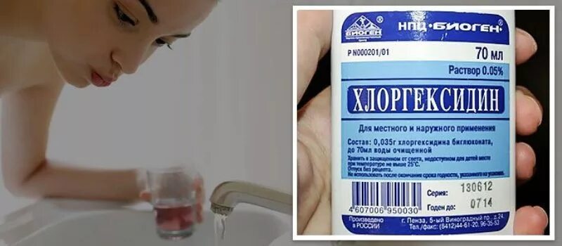 Как полоскать горло хлоргексидином при ангине. Хлоргексидин для полоскания горла. хлоргексидин для полоскания горла при ангине. хлоргексидин раствор для полоскания горла. полоскание рта хлоргексидином.