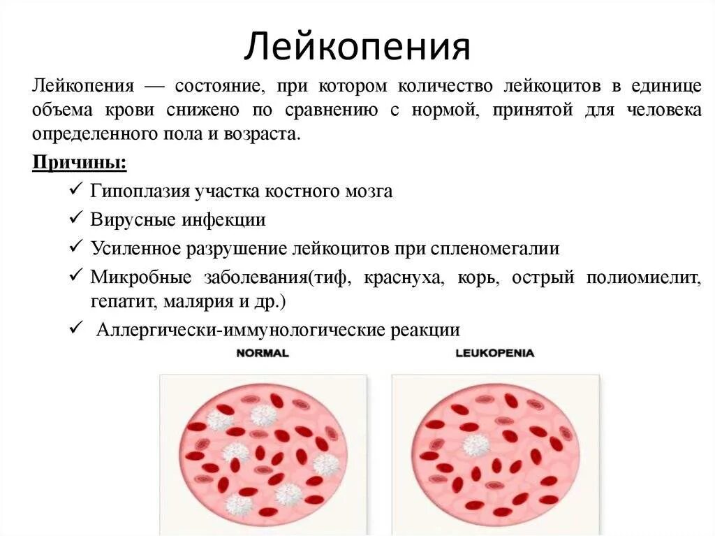 Почему мала лейкоцитов. Лейкоциты. Фрукты для поднятия лейкоцитов. Лейкоциты при аппендиците. Лейкопения.