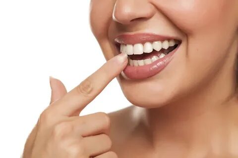 Smile зубы