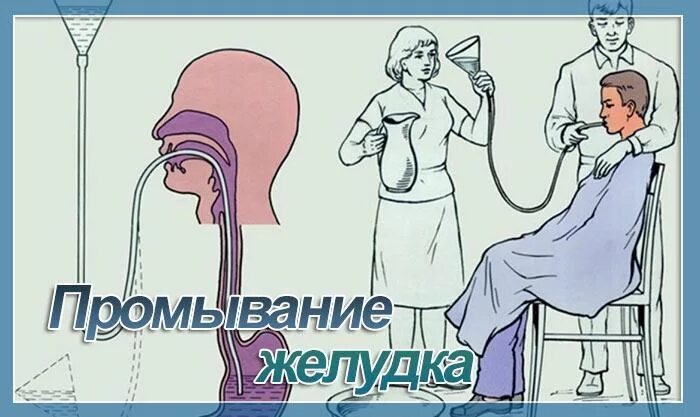 Промывание зонда алгоритм. Техника промывания желудка. промывание желудка алгоритм. промывание желудка манипуляция.