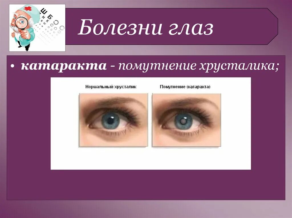 Заболевания глаз список. Болезни зрения у человека список. Заболевание глаз у человека список. Наследственные заболевания зрения