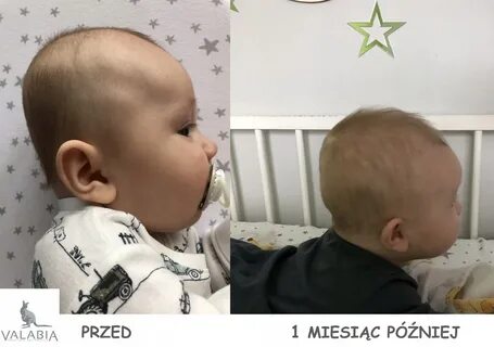 Выравнивание головы