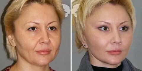 Иванчук пластический хирург