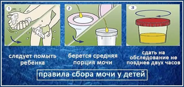 Сбор по нечипоренко у детей