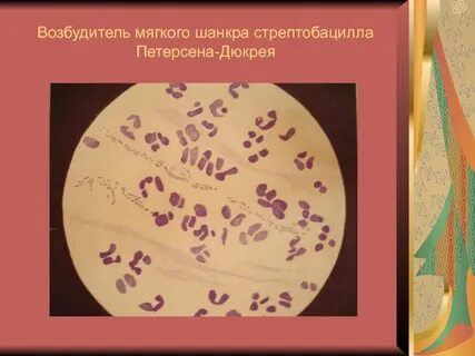 Возбудитель рака