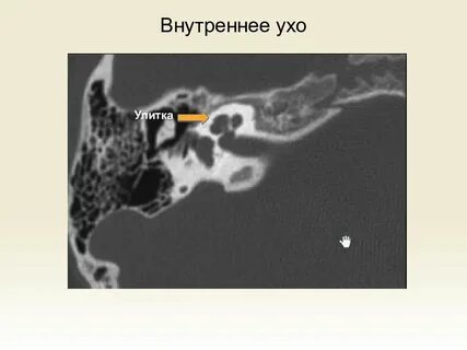 Кт уха