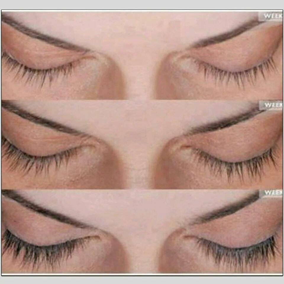 Lash back