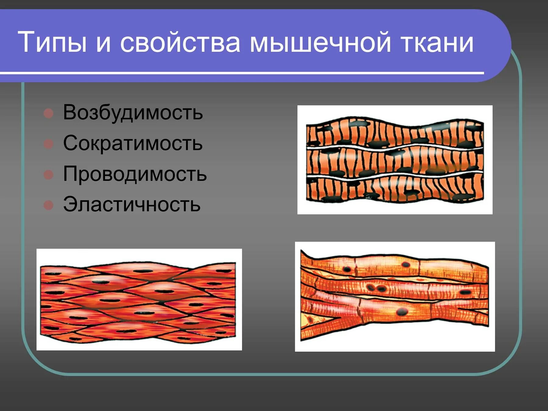 Отличие гладкой и поперечно полосатой ткани. Свойства мышечной ткани возбудимость и сократимость. Поперечно-полосатая Скелетная мышечная ткань рисунок. Строение поперечно полосатой мышцы. Типы скелетных мышечных тканей.