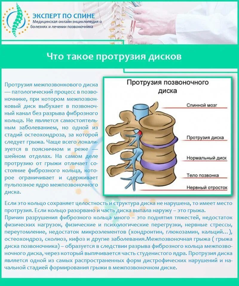 Лечится ли грыжа