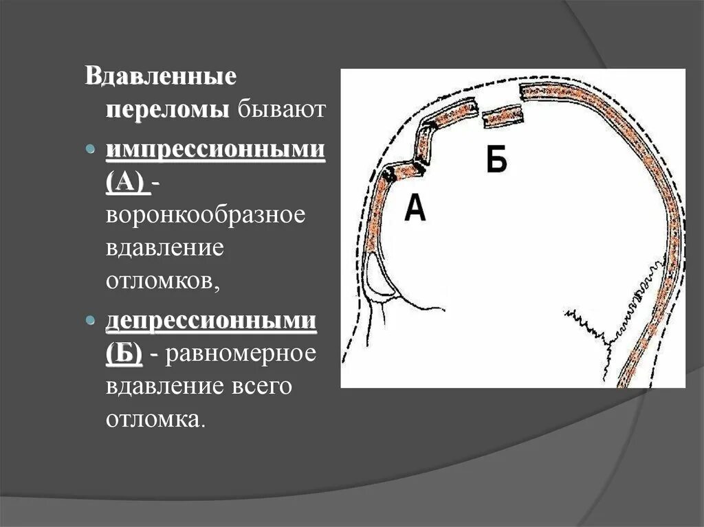 Вдаливать. Вдаливать. Вдаливать. Метод статического вдавливания свай. Машина для вдавливания свай.