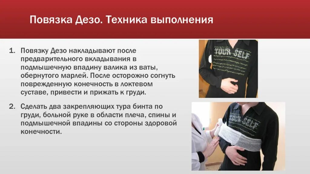 Накладывание повязки Дезо алгоритм. Технику наложения повязки Дезо.. Повязка Дезо техника выполнения. Повязка Дезо техника алгоритм.