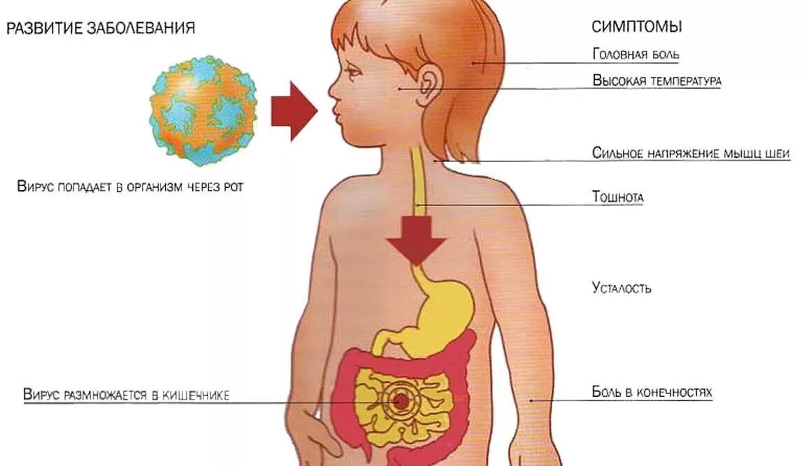 Ротавирусная инфекция у детей. Рвотно вирусная инфекция. Симптомы коронавируса у детей. Вирусные диареи у детей. При орви болит живот