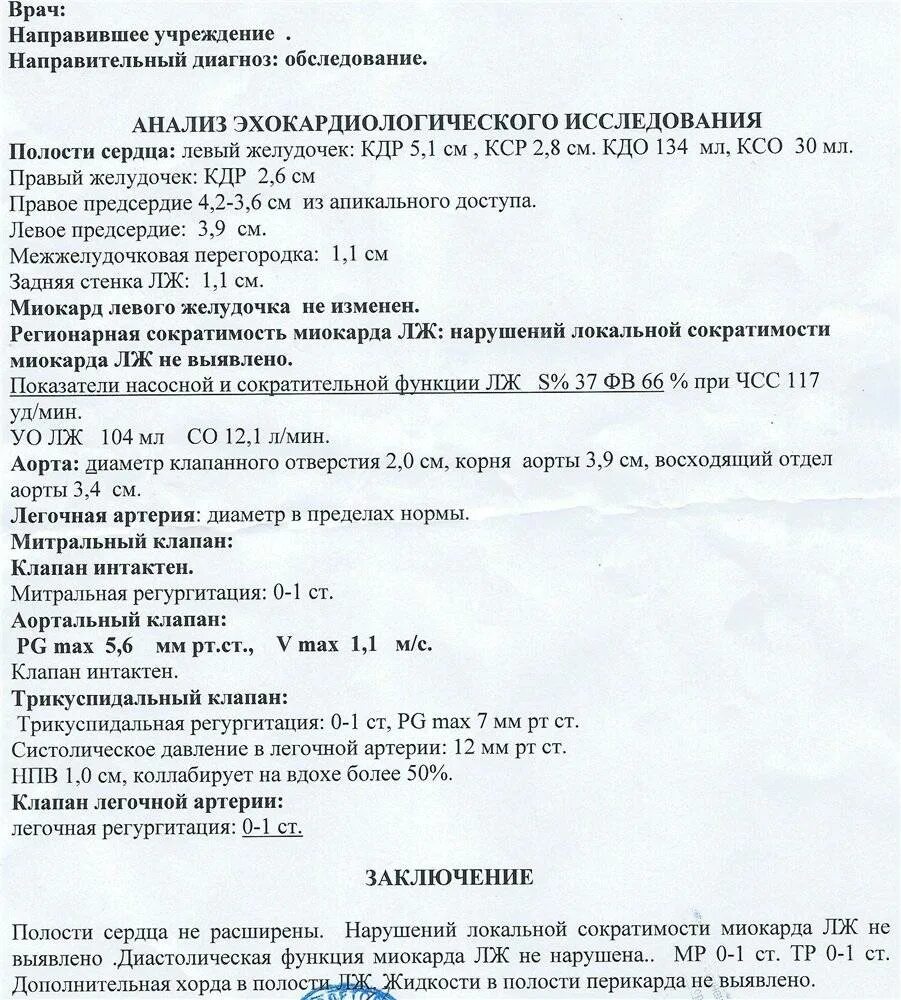 Плохое узи сердца - найдено 90 картинок
