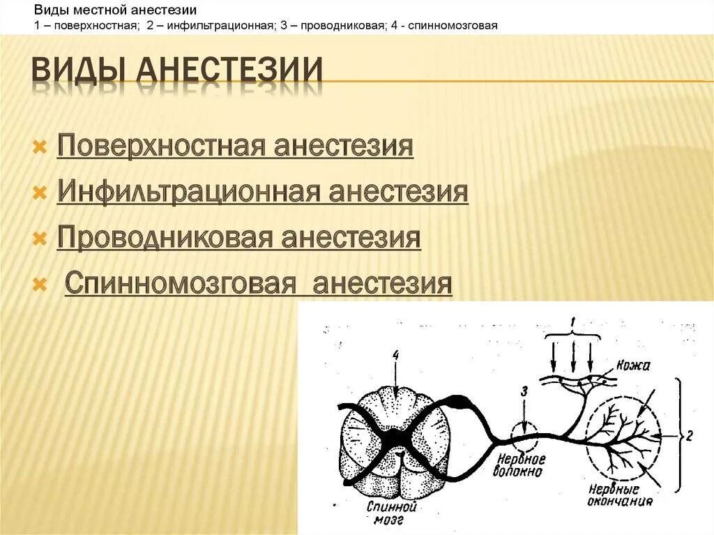 Какие виды местной анестезии. Виды местной анестезии схема. местные анестезии веды. местная анестезия схема. назовите виды местной анестезии.