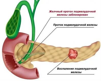 Что такое диффузные изменения паренхимы почек