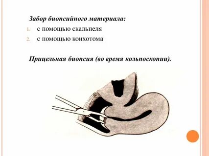 Биопсия эрозии