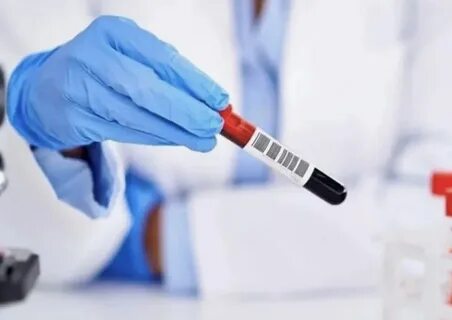 Более 200 жителей Херсонской области приняли участие в оценке группового иммунит