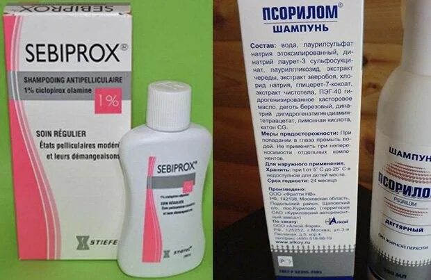 Лучшее средство от перхоти (себореи) - это комплексный подход к лечению: эффекти
