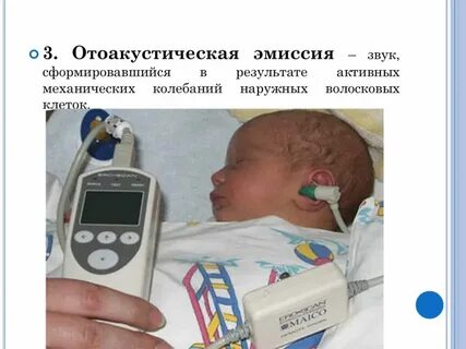 Отоакустическая эмиссия