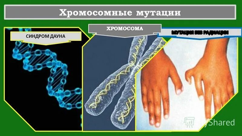 К какой мутации относится синдром дауна. Синдром дауна тип мутации. естественный мутагенез примеры.
