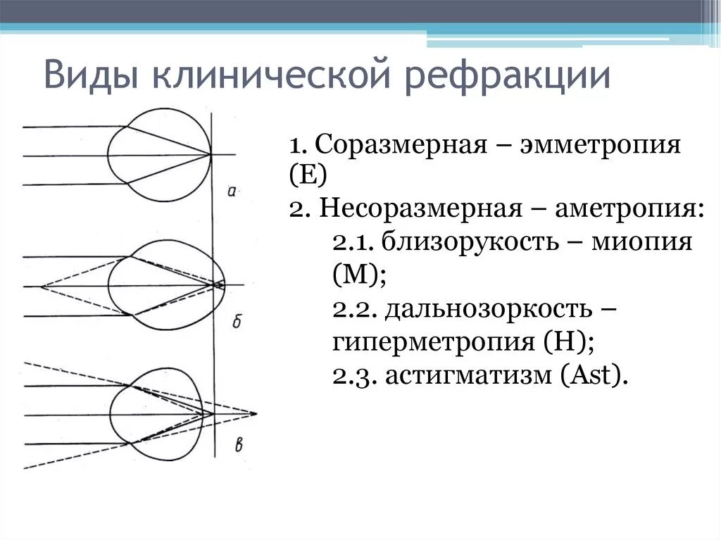 Нарушение рефракции