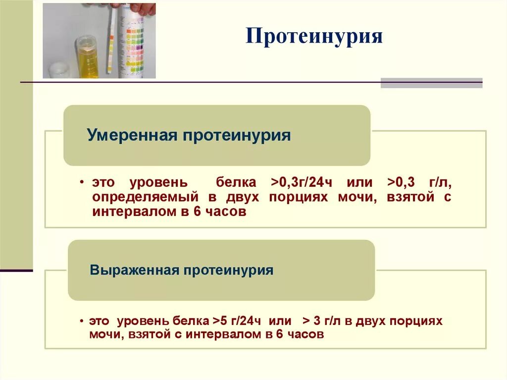 Протеинурия г л