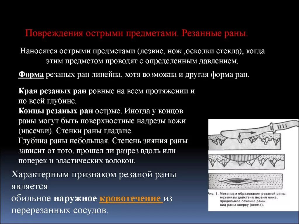 Признаки колото-резаной раны. Механизм образования резаной раны. Резаная рана наносится. Повреждения, причиняемые острыми предметами. Какие раны характеризуются