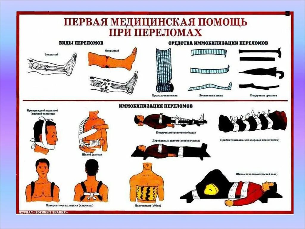 Перелом сустава первая помощь. Оказание первой доврачебной медицинской помощи при переломах. оказание первой медпомощи при переломах. симптомы пмп при переломах. при оказании первой помощи при переломе.