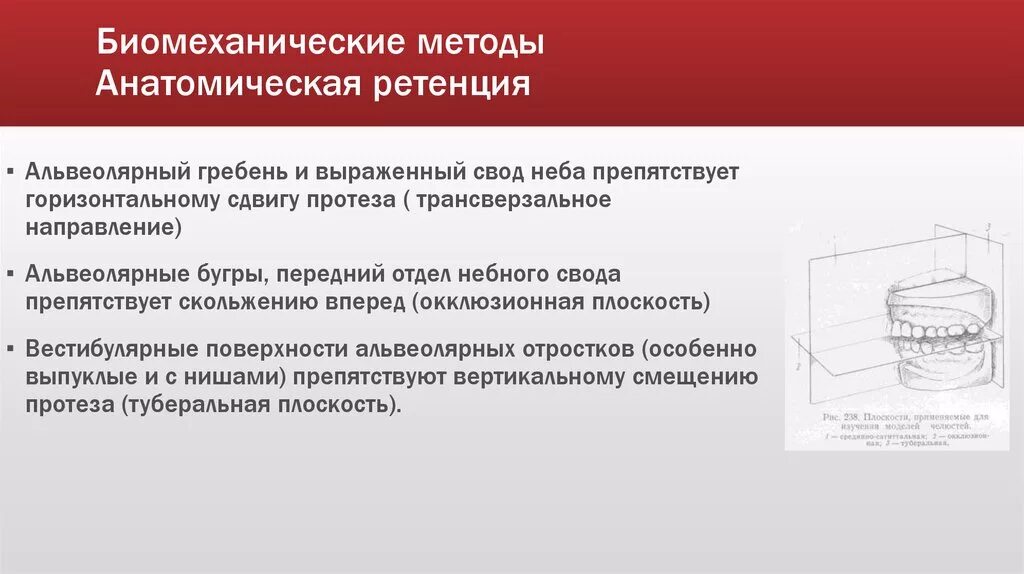 Методы фиксации съемных. Биомеханический метод фиксации протезов. биомеханические методы фиксации полных съемных протезов. анатомическая ретенция протеза. методы фиксации и стабилизации полных съемных протезов.