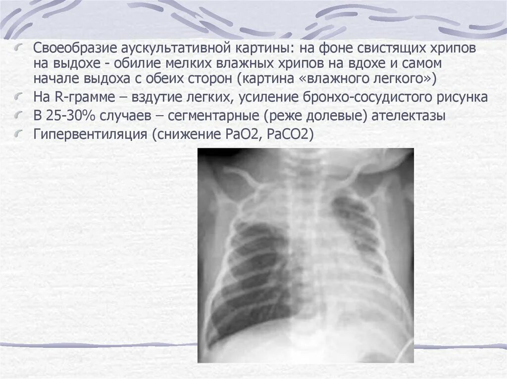 Свист при выдохе в лежачем положении. Хрипы на вдохе у ребенка. влажные хрипы в легких у ребенка. хрип на вдохе и выдохе у ребенка. у ребёнка хрипы при дыхании на выдохе.
