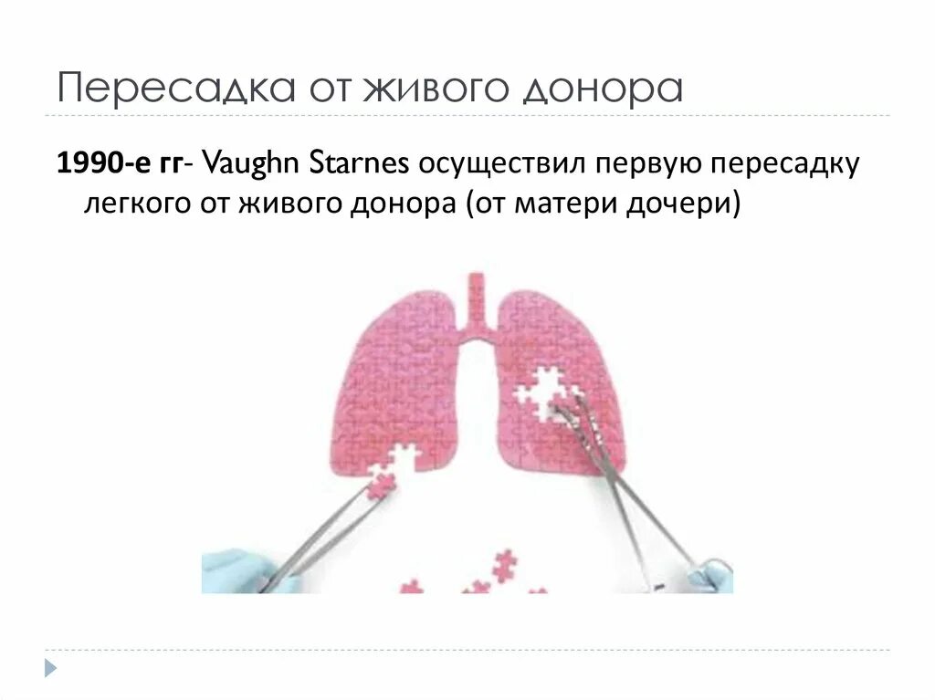 Трансплантация легких презентация. Трансплантация легких схема. Пересадка легких презентация. Трансплантология легких.