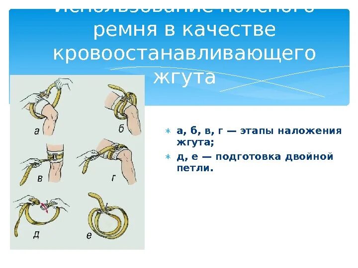 Наложение кровоостанавливающий жгут. Правила наложения кровоостанавливающего жгута. запрещенные зоны при наложении кровоостанавливающего жгута. время наложения кровоостанавливающего жгута.