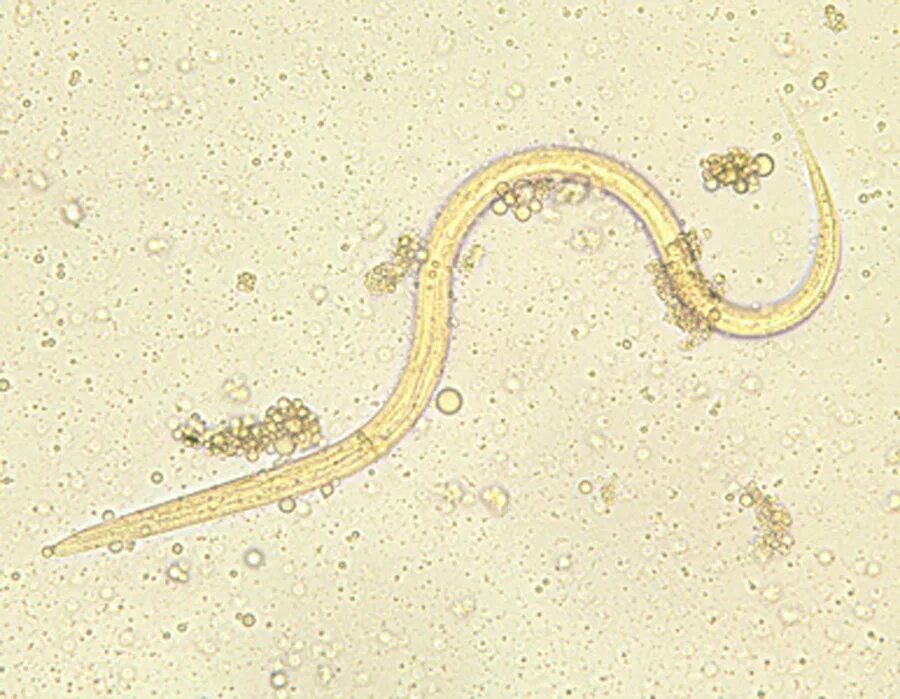 Жизненный цикл угрицы. Угрица кишечная strongyloides stercoralis. Strongyloides stercoralis яйца. Стронгилоидоз (кишечная угрица).