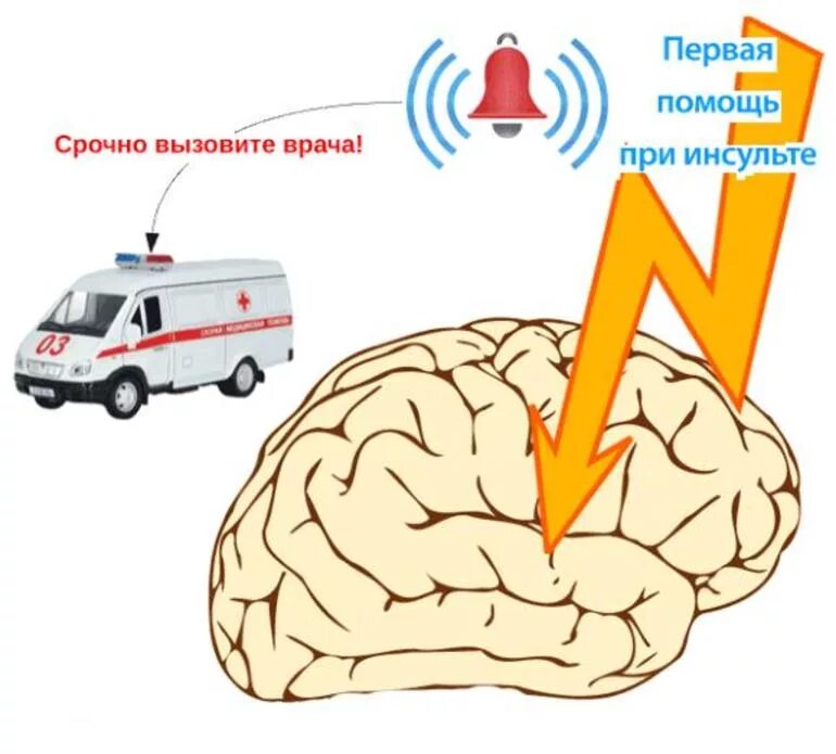 Инсульт вк. Оказание помощи при инсульте. Оказание помощи при инсульте алгоритм. Инсульт первая помощь. Алгоритм помощи при инсульте.