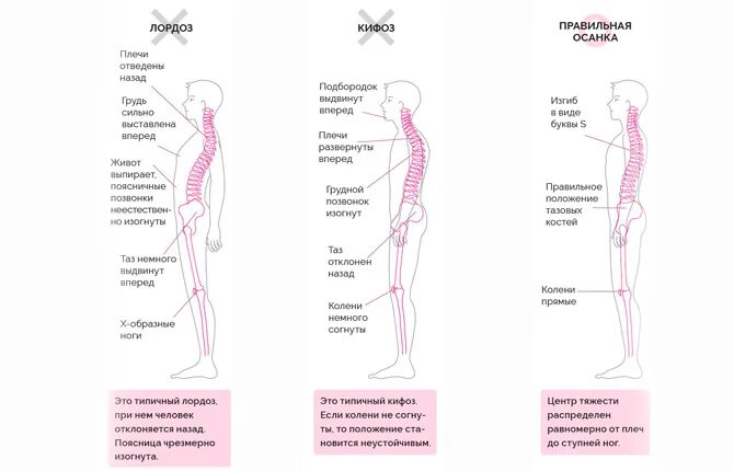 Хрущу поясницей. Хрустит спина как выглядит. Почему хрустит позвоночник. Почему хрустит спина. Хрустят позвонки в спине.