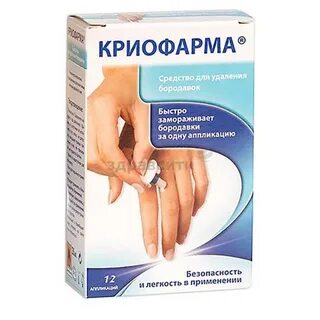 Заморозка бородавок