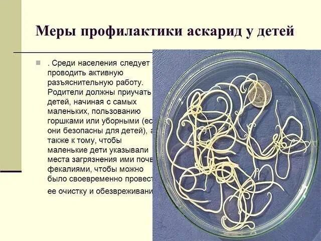 Как вывести аскарид у ребенка. Аскариды у детей симптомы.