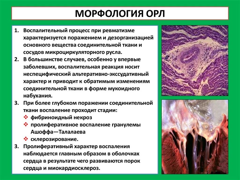 Морфологические изменения болезни. Патоморфология ревматической лихорадки. Поражение сердца при острой ревматической лихорадке. Острая ревматическая лихорадка патоморфология. Ревматизм морфологические изменения.