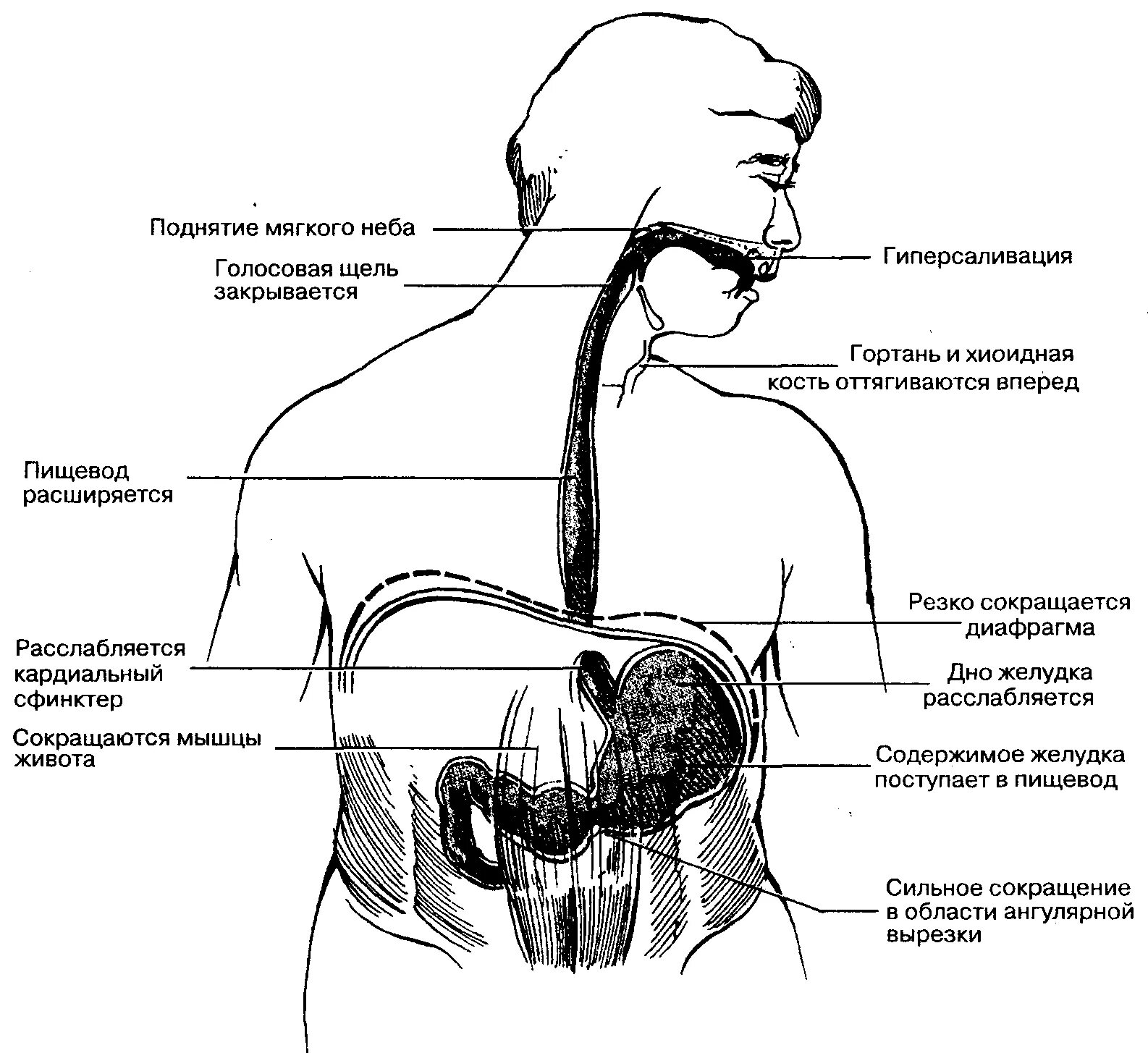 Рвотный рефлекс рвота. Физиологические механизмы рвоты. Акт рвоты. Рвота схема. Схема возникновения рвоты.