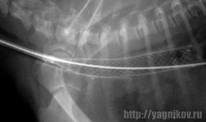 Стентирование собаки. Стентирование трахеи у собак. Коллапс трахеи стентирование. Коллапс трахеи у собак стентирование.