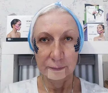 Тейпирование лица помогает