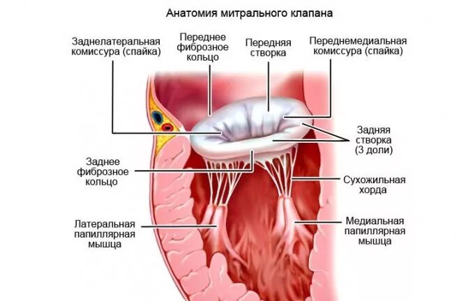 Уплотнение стенок аорты и створок аортального