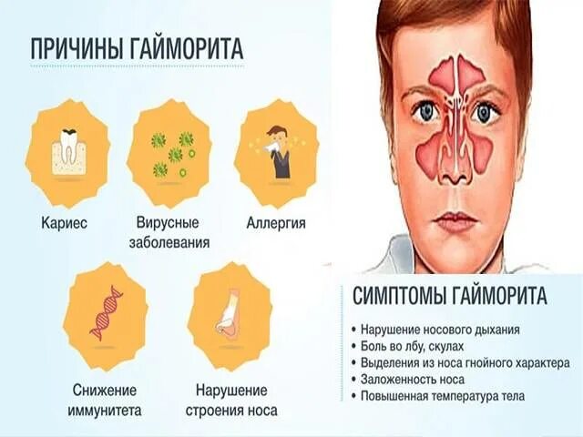 Фронтит температура