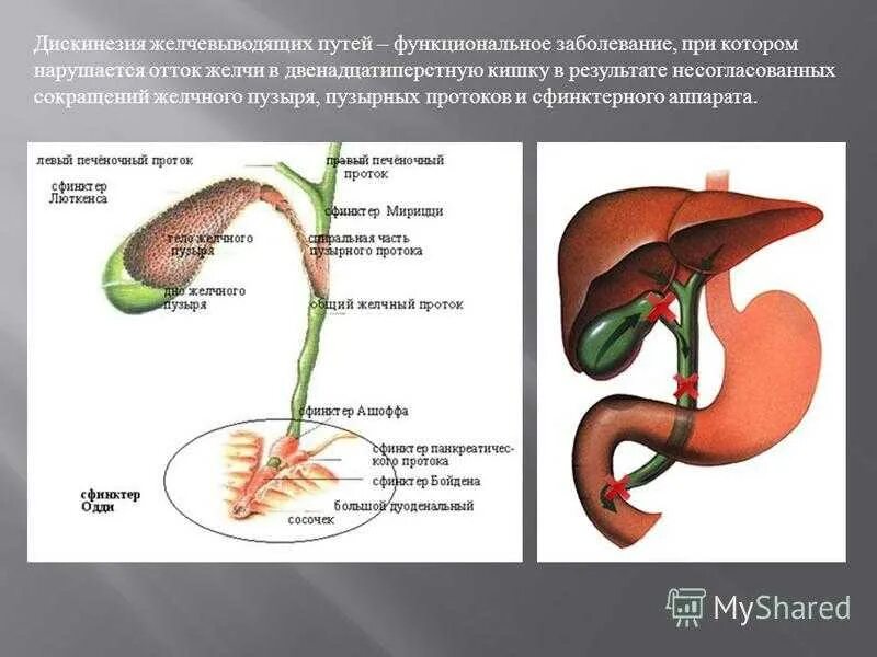 Заболеваний желчевыводящих