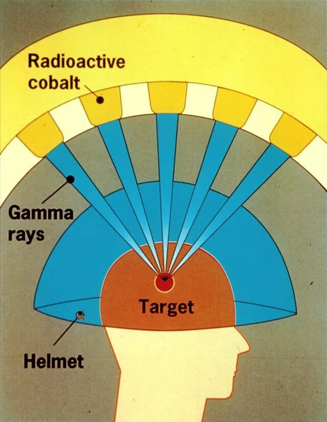 Gamma i