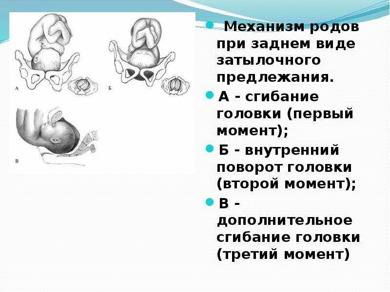 Механизм родов головном предлежании. Биомеханизм родов внутренний поворот головки. Биомеханизм родов затылочное предлежание ЗАДНИЙИЙ вид. Механизм родов в переднем виде затылочного предлежания. Путь ребенка во время родов