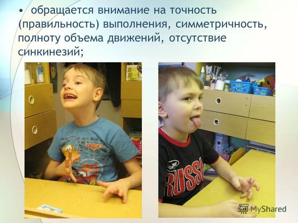 патологические синкинезии. патологические синкинезии. синкинезии и гиперкинезы в логопедии. синкинезии в логопедии. синкинезии.