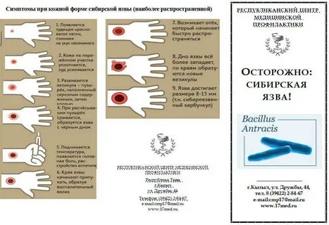 Инфекция сибирской язвы